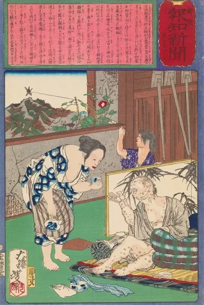 Toshima Tomiyo Who Stayed With Her Leper Husband Tomozo