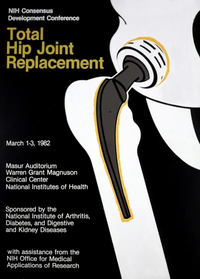 Total Hip Joint Replacement