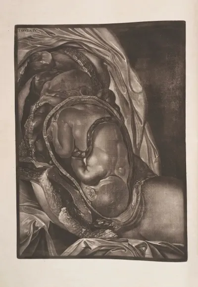 We Have Represented The Child As Turned In The Passage For A Natural Birth