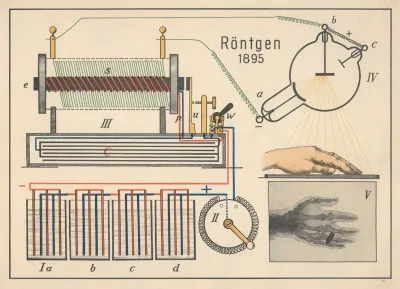 X Rays