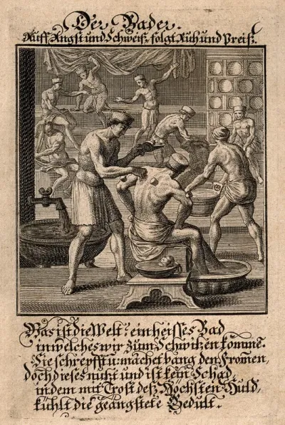 A bathing room attendant applying the method of cupping to a male customer in an active bathing house