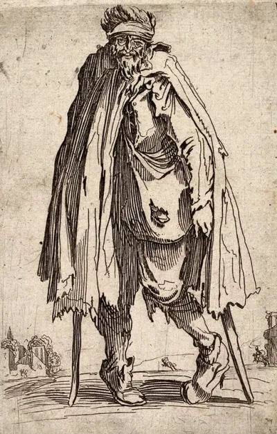 A bearded beggar with a misshapen left leg standing with two crutches
