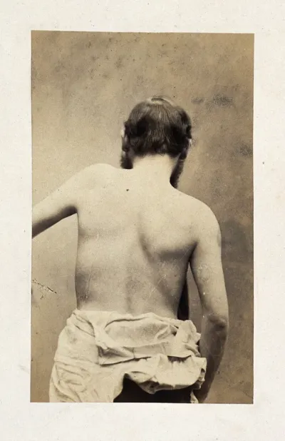 A bearded man, unclothed to his waist and viewed from behind; his left arm slightly raised