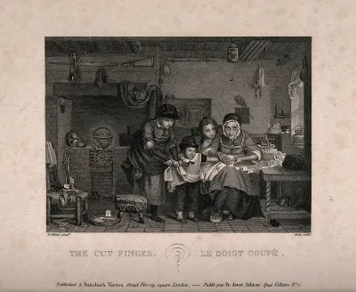 A boy with a cut finger is treated by his mother, while two other siblings hold him as he resists