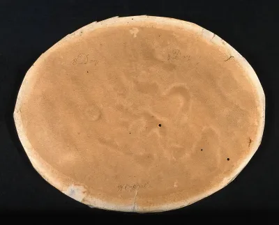 A comparison between a cowpox and smallpox pustule on the eighth day of the disease