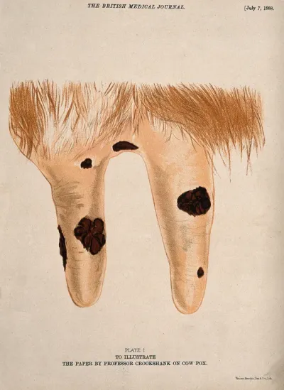 A cow's udder with vaccinia pustules