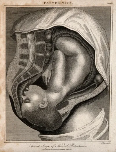 A cross-section of a pregnant woman's body in the final stages of labour