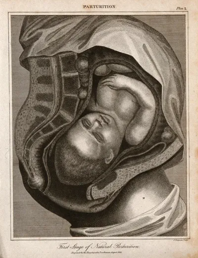 A cross-section of a pregnant woman's body just before she gives birth