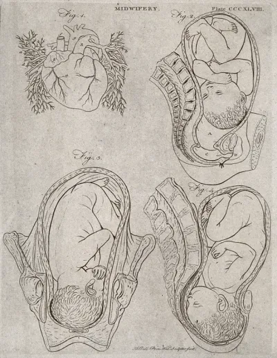 A diagram of the heart and three illustrations of babies in the womb