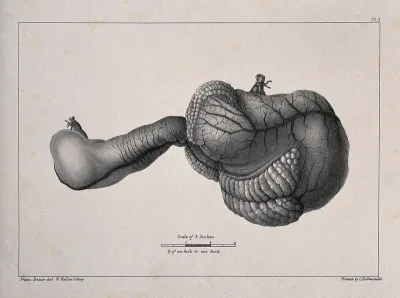 A diseased part of the body