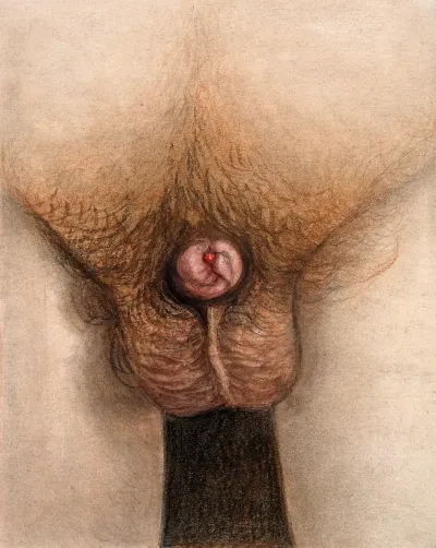 A diseased penis, showing symptoms of phagedena