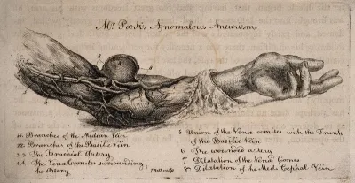 A dissected arm showing arteries, numbered for key