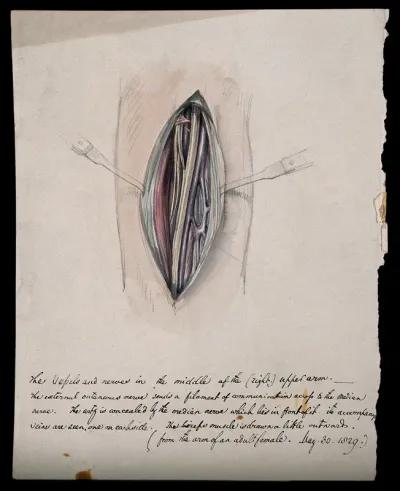 A dissected arm
