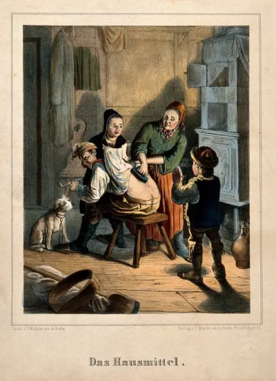 A domestic remedy: a woman applies a hot iron to her husband's back while their two children look on