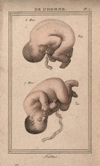 A foetus shown at six and at seven months
