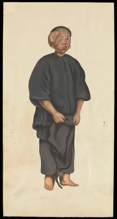 A girl (Akae) with a tumour over her right eye
