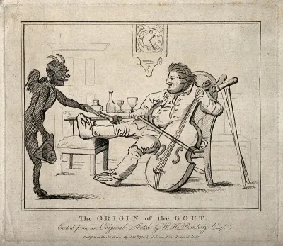 A gouty man drinking wine and playing the cello; the pain is represented by a devil burning his knee
