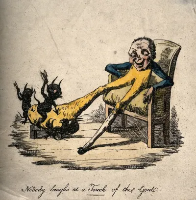 A gouty man suffering with a painfully enlarged foot; presented by demons prodding it with arrows
