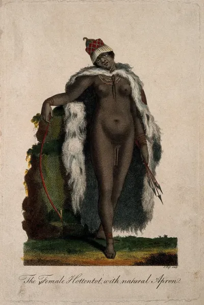 A "Hottentot" woman with large labia pudendi