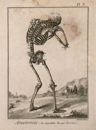 A human skeleton, seen from the back, bent forward with his hands clasped to his skull, after Vesalius