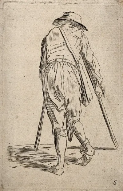 A lame beggar moving with crutches seen from behind