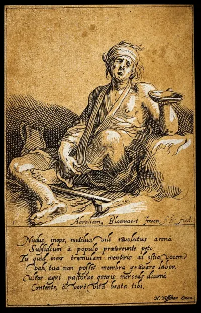 A lame man sitting on the ground with his injured leg in a sling begging for alms