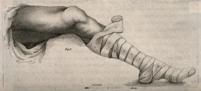 A leg bandaged to just below the knee