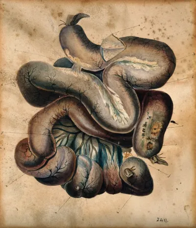 A length of coiled intestine