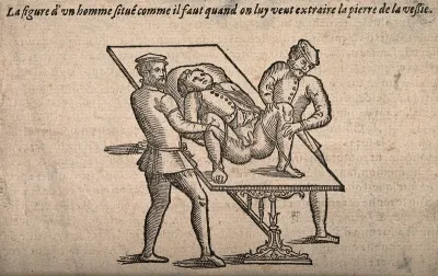 A male patient on a table being held in the lithotomy position by two assistants