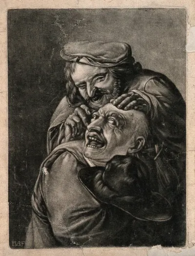 A malicious itinerant surgeon extracting stones from a grimacing patient's head; symbolising the extraction of 'folly' (insanity)