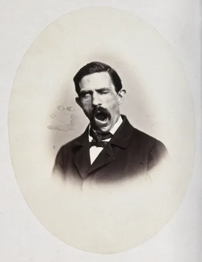 A man, head and shoulders; his face is contorted