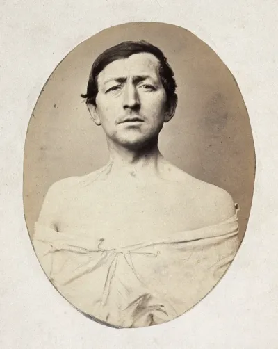 A man, head and shoulders; his shirt undone
