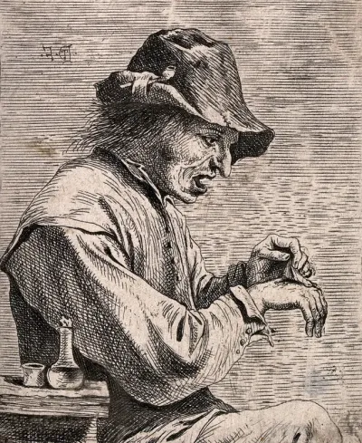 A man removing a plaster from his hand