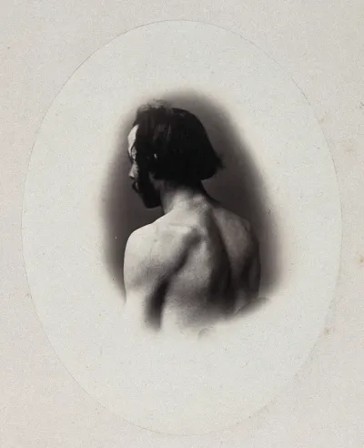 A man's head and left shoulder, unclothed and viewed from behind
