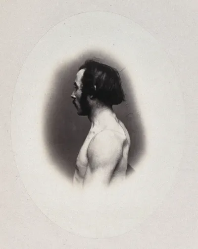 A man's head and left shoulder, unclothed and viewed from the side