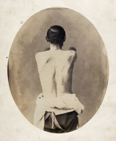 A man's naked torso viewed from the back, with his arms stretched out in front