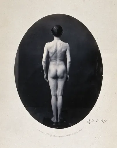 A man standing, naked, full-length, viewed from behind