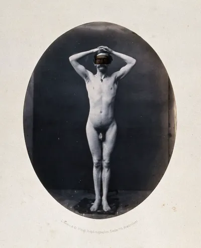 A man standing, naked, full-length, with hands on head