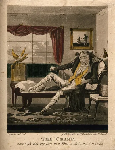 A man suffering from cramp in the leg
