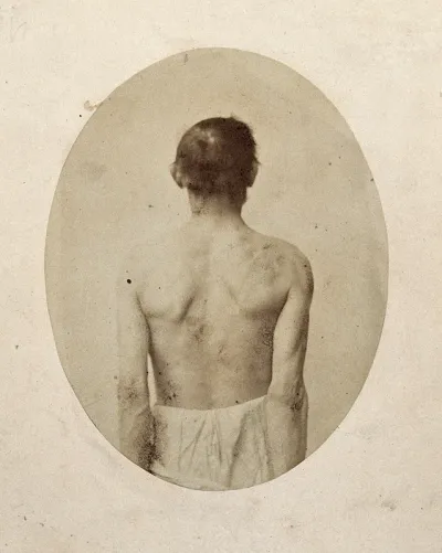 A man, viewed from behind, unclothed to waist with shoulders slightly pushed back
