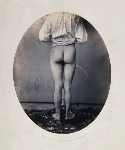A man, viewed from behind, with naked legs and buttocks
