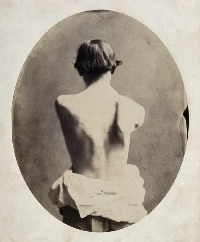A man, viewed from the back, who is holding his arms out in front of his body, revealing mobility of right shoulder