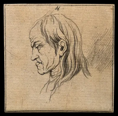 A man whose face exemplifies the melancholy temperament