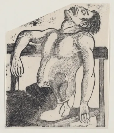 A man with a small foot emerging from his side