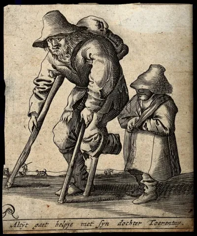 A man with one foot moves with crutches accompanied by a little girl wearing a hat and her arm in a sling