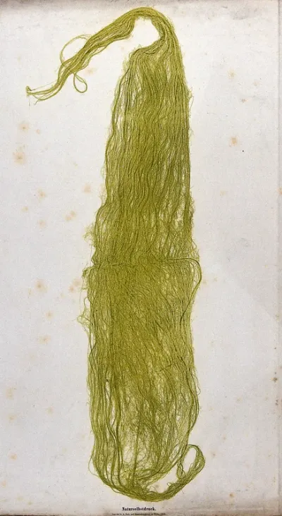 A mass of filamentous green algae, possibly a Spirogyra species