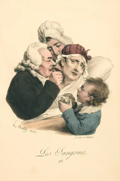 A medical practitioner administers leeches to a patient