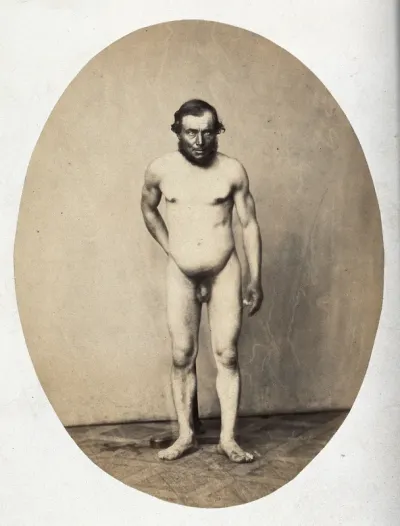 A naked man, standing, viewed in full length from the front; he is holding on to a stand, just discernible behind his back