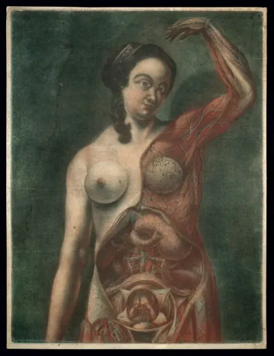 A pregnant woman with the left side of her upper body and viscera exposed, her left arm raised above her head