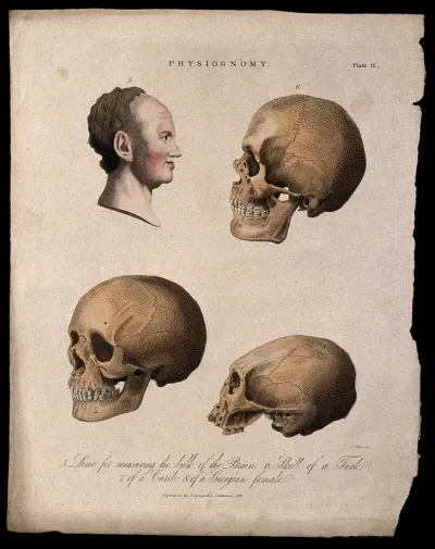 A profile of a man bisected with a curve for measuring the brain, skulls of a Turk (top right), a Georgian woman (bottom left) and a Caribbean (bottom right)